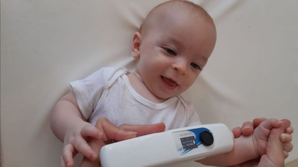 MyOR tests babies’ skin barriers as one of the factors that determines the risk for developing allergies. (Courtesy of MyOR)