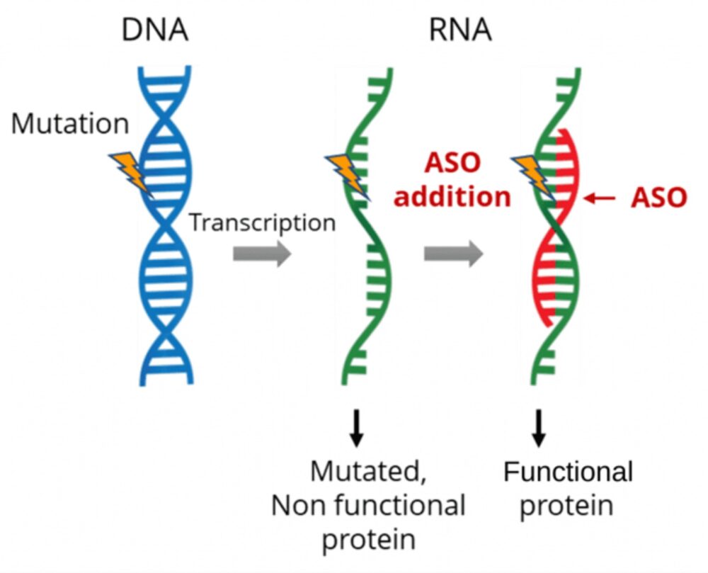 This diagram shows how ASO splices in the other half of this RNA strand to create a fully functional protein. (Courtesy of SpliSense)