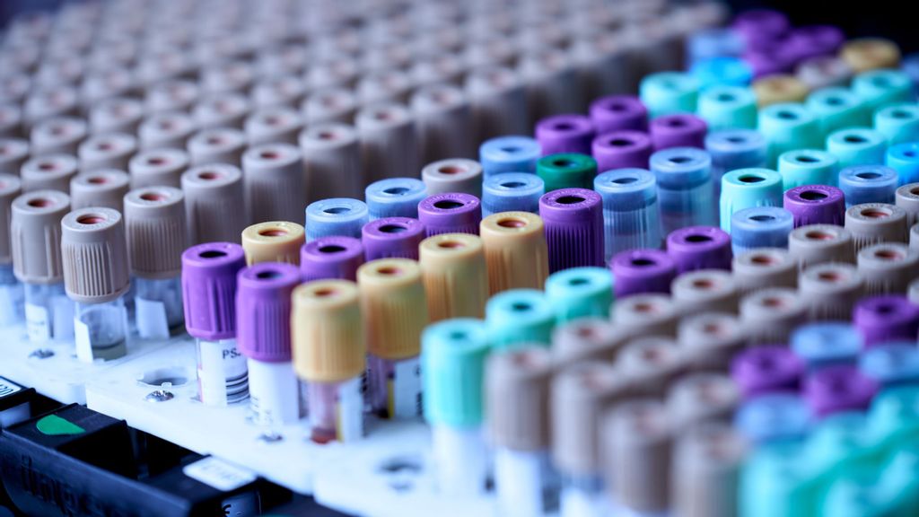 A whole-genome sequencing method, aided by artificial intelligence, enables early detection of persistent or recurrent cancer cells from a standard blood sample. (Testalize.me/Unsplash)