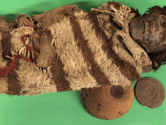 A mummy of the Ansilta people of the Andes Mountains had head lice that cemented nits to hair, encasing DNA that offers clues about human migration 1,500 to 2,000 years ago. (Courtesy San Juan National University, Argentina)
