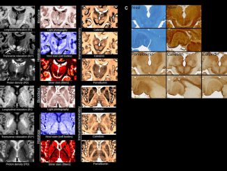 The comprehensive multi-modal dataset which offers a rich variety of views of the tissue microstructure (here with different sensitivity to nerve fibers, nerve cells and blood vessels). (MPI for Human and Cognitive Sciences, Science Advances/Zenger)