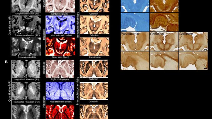The comprehensive multi-modal dataset which offers a rich variety of views of the tissue microstructure (here with different sensitivity to nerve fibers, nerve cells and blood vessels). (MPI for Human and Cognitive Sciences, Science Advances/Zenger)