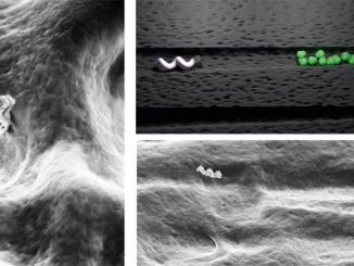 Left: Nanobots entering a dentinal tubule. Centre top and bottom: Schematic representation and electron microscope image of nanobot moving through dentinal tubule to reach bacterial colony. Right: How locally induced heat from nanobot can kill bacteria. Live bacteria are green and dead bacteria are red. Bottom right shows band where targeted treatment has been done in human teeth. (Theranautilus/Zenger)