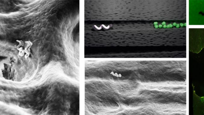 Left: Nanobots entering a dentinal tubule. Centre top and bottom: Schematic representation and electron microscope image of nanobot moving through dentinal tubule to reach bacterial colony. Right: How locally induced heat from nanobot can kill bacteria. Live bacteria are green and dead bacteria are red. Bottom right shows band where targeted treatment has been done in human teeth. (Theranautilus/Zenger)