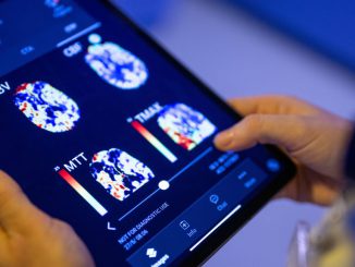 strongA radiologist at Unfallkrankenhaus Berlin looks at a patient's brain images in an AI-based app on a tablet. Artificial intelligence is the answer to the world's soaring healthcare expenses, staff shortages at crisis levels, and exponential expansion in medical data. MONIKA SKOLIMOWSKA/PICTURE ALLIANCE/GETTY IMAGES/strong