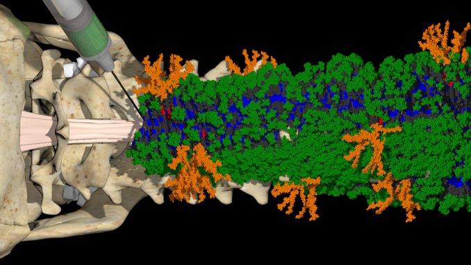 A new injectable therapy forms a nanofiber scaffold with two different bioactive signals (green and orange) that communicate with cells to initiate repair of the injured spinal cord. The gel breaks down into cell nutrients and dissipates over time. (Illustration by Mark Seniw. Samuel I. Stupp Laboratory/Northwestern University)