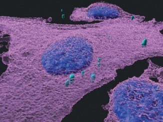 Israeli researchers have developed an immunotherapy platform that inhibits melanoma. (Courtesy of Weizmann Institute of Science)
