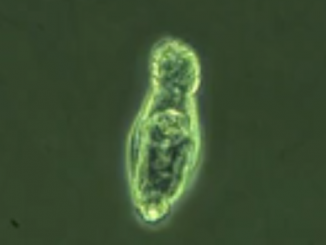 The bdelloid rotifer is a tiny freshwater creature that can be found around the world. It is about the thickness of a piece of paper or just a hair larger. (Soil Cryology Laboratory)