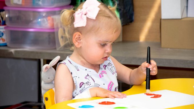 Grace Westwood, 2, born with a heart muscle disease, received a life-saving transplant after being kept alive with a fitted mobile “Berlin Heart” driving unit. Undated photograph. (NEWCASTLE UPON TYNE HOSPITALS NHS FOUNDATION TRUST, SWNS/Zenger)