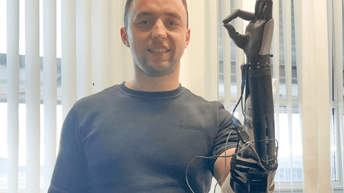State-of-the-art bionic arms for Ukrainian soldier amputees. A British tech company has flown to Germany to fit bionic hands to two wounded Ukrainian soldiers. OPEN BIONICS/SWNS TALKER