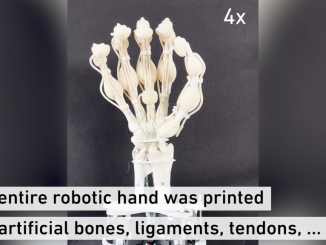 A robotic hand complete with bones, ligaments and tendons has been created for the first time using the latest 3D printing technology. PHOTO BY THOMAS BUCHNER/SWNS