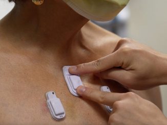 The wearable device. A new wireless acoustic device developed by scientists can listen to and monitor our bodies better than doctors, potentially saving thousands of lives. PHOTO BY NORTHWESTERN UNIVERSITY/SWNS 