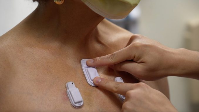 The wearable device. A new wireless acoustic device developed by scientists can listen to and monitor our bodies better than doctors, potentially saving thousands of lives. PHOTO BY NORTHWESTERN UNIVERSITY/SWNS 