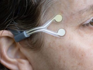 NeuroTrigger is a pacemaker for blinking in people with facial paralysis. SRAYA DIAMANT.