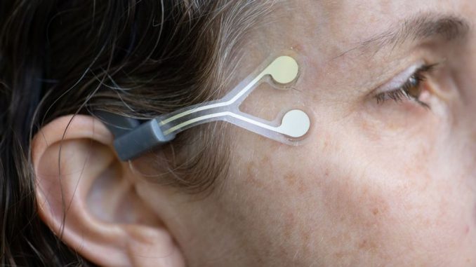 NeuroTrigger is a pacemaker for blinking in people with facial paralysis. SRAYA DIAMANT.